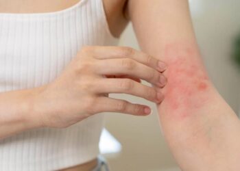 Inscrições abertas para palestra sobre esporotricose, doença causada por fungos